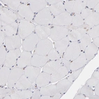 Immunohistochemical staining of human skeletal muscle shows no positivity in cells in glomeruli.