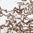 Immunohistochemical staining of human lung shows membranous positivity in pneumocytes.