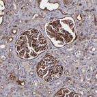 Immunohistochemical staining of human kidney shows strong membranous positivity in cells in glomeruli.