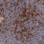 Immunohistochemical staining of human lymph node shows moderate membranous positivity.