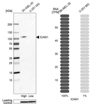 Western blot analysis in human cell lines SK-MEL-30 and U-251MG using Anti-ICAM1 antibody. Corresponding ICAM1 RNA-seq data are presented for the same cell lines. Loading control: Anti-HDAC1.