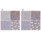 Immunohistochemical staining of human liver, lymph node, pancreas and rectum using Anti-CD14 antibody HPA002127 (A) shows similar protein distribution across tissues to independent antibody HPA001887 (B).