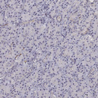 Anti-CD14 Antibody