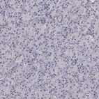Immunohistochemical staining of human pancreas shows no positivity in exocrine glandular cells as expected.