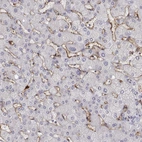 Immunohistochemical staining of human liver shows moderate to strong membranous positivity in hepatic sinusoid cells.