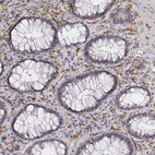 Anti-CD14 Antibody