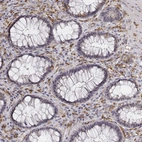 Immunohistochemical staining of human rectum shows moderate to strong cytoplasmic positivity in lymphoid cells.
