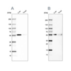 Western blot analysis using Anti-CD14 antibody HPA002127 (A) shows similar pattern to independent antibody HPA001887 (B).
