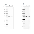 Western blot analysis using Anti-CD14 antibody HPA002127 (A) shows similar pattern to independent antibody HPA001887 (B).