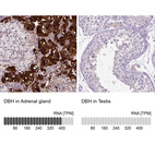 Anti-DBH Antibody