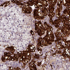 Immunohistochemical staining of human adrenal gland shows strong cytoplasmic positivity in glandular cells.