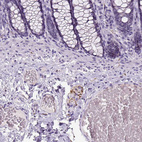 Immunohistochemical staining of human colon shows strong cytoplasmic positivity in peripheral ganglion.