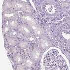 Immunohistochemical staining of human kidney shows no weak positivity in cells in tubules as expected.