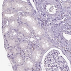 Immunohistochemical staining of human kidney shows no weak positivity in cells in tubules as expected.