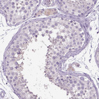 Immunohistochemical staining of human testis shows no positivity in cells in seminiferous ducts as expected.