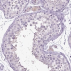 Immunohistochemical staining of human testis shows no positivity in cells in seminiferous ducts as expected.