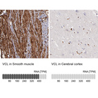 Anti-VCL Antibody