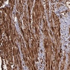 Immunohistochemical staining of human smooth muscle shows strong cytoplasmic positivity in smooth muscle cells.
