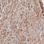 Immunohistochemical staining of human prostate shows moderate cytoplasmic positivity in smooth muscle cells.