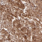 Immunohistochemical staining of human heart muscle shows moderate cytoplasmic positivity in cardiomyocytes.