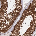 Immunohistochemical staining of human testis shows strong cytoplasmic positivity in cells in seminiferous ducts.