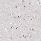 Immunohistochemical staining of human cerebral cortex shows no positivity in neuronal cells.