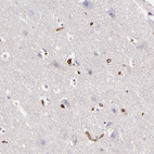 Anti-VCL Antibody