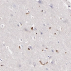 Immunohistochemical staining of human cerebral cortex shows no positivity in neuronal cells.