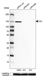 Western blot analysis in U-87MG ATCC cells transfected with control siRNA, target specific siRNA probe #1 and #2, using Anti-VCL antibody. Remaining relative intensity is presented. Loading control: Anti-GAPDH.