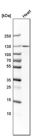 Western blot analysis in human heart tissue.
