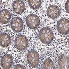 Immunohistochemical staining of human colon shows moderate cytoplasmic positivity in glandular cells.