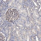 Immunohistochemical staining of human kidney shows moderate membranous positivity in cells in glomeruli and tubules.