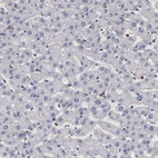 Anti-ESYT2 Antibody