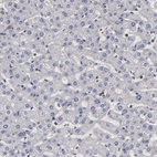 Immunohistochemical staining of human liver shows no cytoplasmic positivity in hepatocytes as expected.