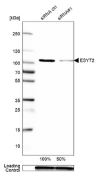 Western blot analysis in MCF-7 cells transfected with control siRNA, target specific siRNA probe #1, using Anti-ESYT2 antibody. Remaining relative intensity is presented. Loading control: Anti-GAPDH.