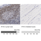 Anti-IFI16 Antibody