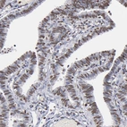 Immunohistochemical staining of human Fallopian tube shows moderate nuclear positivity in glandular cells.
