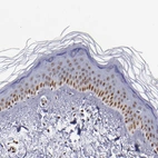 Immunohistochemical staining of human skin shows moderate nuclear positivity in squamous epithelial cells.