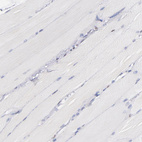 Immunohistochemical staining of human skeletal muscle shows no positivity in myocytes as expected.