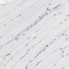 Immunohistochemical staining of human skeletal muscle shows no positivity in myocytes as expected.