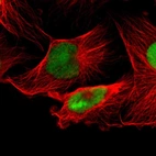 Immunofluorescent staining of human cell line U-251 MG shows localization to nucleus & nucleoli.