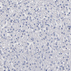 Anti-FABP4 Antibody