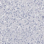 Immunohistochemical staining of human liver shows no cytoplasmic positivity in hepatocytes as expected.