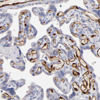 Anti-FABP4 Antibody