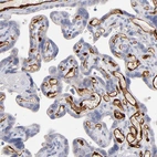 Immunohistochemical staining of human placenta shows strong cytoplasmic positivity in endothelial cells.