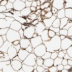Immunohistochemical staining of human adipose tissue shows strong cytoplasmic positivity in adipocytes.