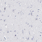 Anti-FABP4 Antibody