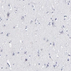 Immunohistochemical staining of human cerebral cortex shows no cytoplasmic positivity in neurons as expected.