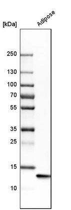 Western blot analysis in human adipose tissue tissue.