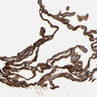 Immunohistochemical staining of human lung shows strong membranous and cytoplasmic positivity in pneumocytes.